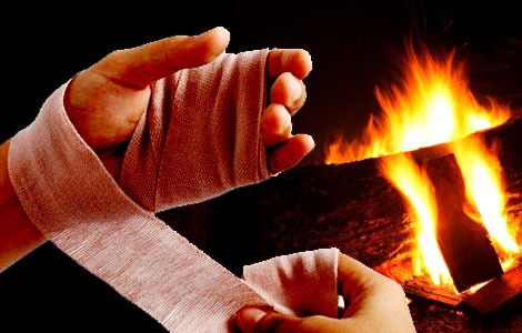 Queimaduras: o que fazer? – Por Dr Cyro Hirano